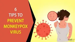 6 Tips to Prevent Monkeypox Virus