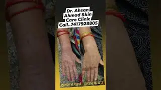 Ahmad Skin Care Clinic WhatsApp No. +91 7417928805(3)