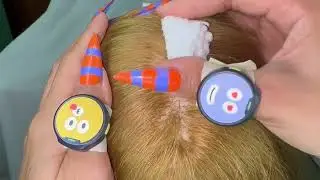 Gentle Scratch & Scrape: Long Nails Dandruff Removal (ASMR Scalp) IMG 6150