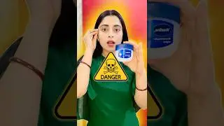 Don&rsquo;t Mix These 4 Ingredients with Vaseline 😱 | Big Skincare Mistake! || #shorts#ytshorts#skincare