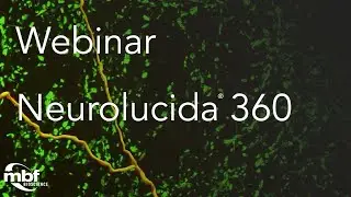 Webinar: Automatically Analyzing Puncta with Neurolucida 360
