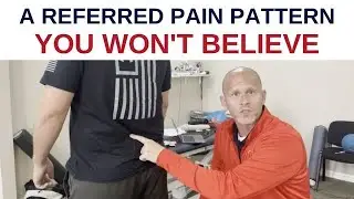 A Referred Pain Pattern You Won&rsquo;t Believe