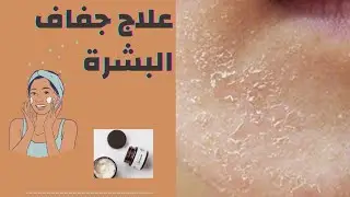 تخلص من جفاف الجلد والبشرة نهائيا👌💗