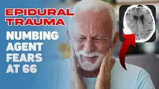 Epidural Trauma: Numbing Agent Fears at 66 🦷🚨🤕
