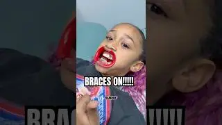 Londyn was SO NERVOUS!! Do you have braces? #shorts #londyn #dlafam #shorts