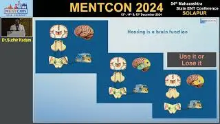 Neonatal Hearing Screening by Dr. Sudhir Kadam