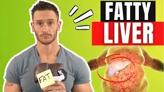 New &ldquo;5:2 Fasting&rdquo; Method Reduces Fatty Liver