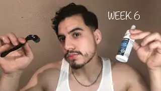 Growing my beard with minoxidil week 6