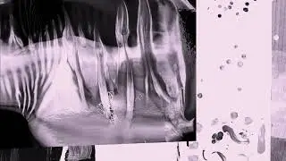 TR/ST - Iris