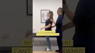 Пациент не может сгибаться назад и приседать. Вправление кости CLM исправлено немедленно. #chrisl...