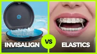 Invisalign and Elastics and TRACKING- What NOT to do!