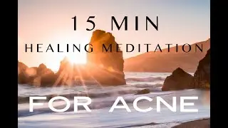 Healing Acne || 15min Guided Meditation for Hormonal Acne / PCOS / Clear Skin | Delta Binaural Beats