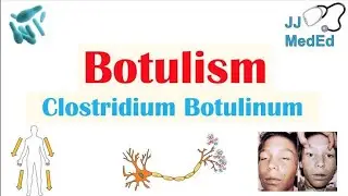 What is the main signs&causes of botulism? Dr Health Officials