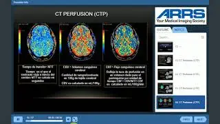 INFARTO E ISQUEMIA CEREBRAL EN TC y RM /CURSO NEURORRADIOLOGIA #2 brain ISCHEMIA CT and MRI