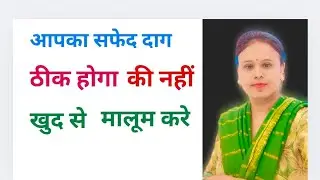 Safed daag ka ilaaj How to get rid of white spots#vitiligo treatment#