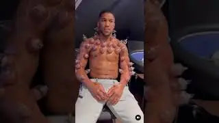 Anthony Joshua recovery 😟
