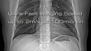 Direct Conversion: leading X-ray imaging technology