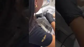 Izrada retainera u MB Lab-u - MB Dent