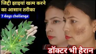 ❣️चाची की 10 साल पुरानी झाइयां सिर्फ 2 दिन में गुड़ से गई,वो गोरी भी हुई 😍
