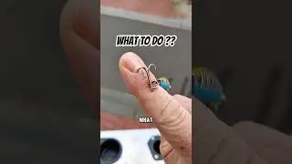 How to Remove a Fishhook Safely from Your Finger