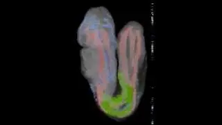 EMA24 ts13 view4