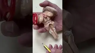 Anatomy of Brain Stem Practical