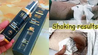 NEUD Hair Remover Spray For Men And Women | 100% True Result With Best Budget Product