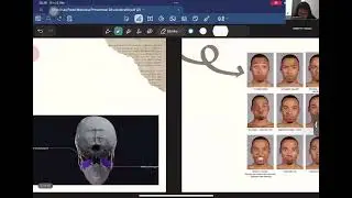 ￼Situs Facialis