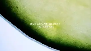 Microscope Photography II Shot on iPhone