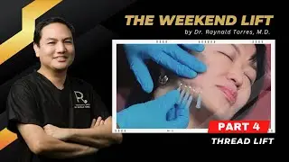 The Weekend Lift Part 4: Thread Lift