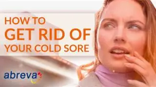 How To Get Rid of a Cold Sore | Abreva&reg;