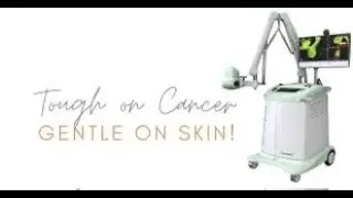 IG-SRT Image Guided Superficial Radiation Therapy for skin cancer (basal cell carcinoma)