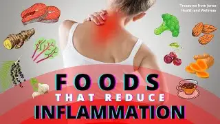 18 Best Anti-Inflammatory Foods That Reduce Chronic Pain and Inflammation