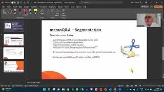 Why is my segmentation bad?