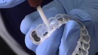 Incognito Hidden Braces