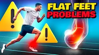 Is RUNNING With Flat Feet DANGEROUS?