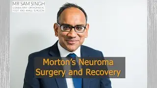 Morton&rsquo;s Neuroma Surgery and Recovery
