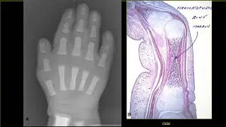 Osteogenesis 2 - Circulation