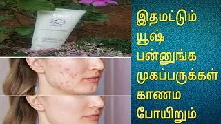 kaya acne free face wash review in Tamil
