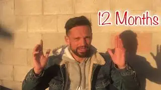 2ND FUE Hair Transplant | 12 MONTHS | Hair Medical Restoration | Tijuana |12 Months Minoxidil Use