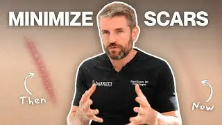The Fastest Ways to Make Scars Less Noticeable!