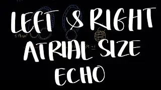 Left and Right Atrial Size using Echo