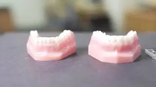 Butler Smiles Dental Care - Orthodontics