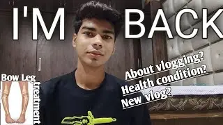 My Opration journey[]Bow Leg treatment[]My pain, Struggles And Full Recovery 