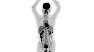 Human Images from World&rsquo;s First Total-Body PET Scanner Unveiled