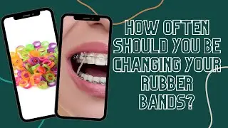 How Often Should You Be Changing Your Rubber Bands? #shorts