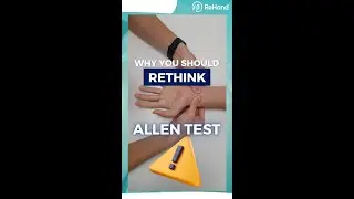 Allen Test for Hand Vascularization | Hand Therapy