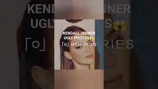 KENDALL JENNER UGLY PHOTOS ? 😱