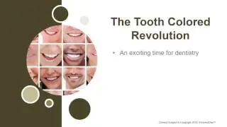Tooth Colored Fillings in Granbury, TX at Lakeview Dental - Dr. Jonathan Heizer