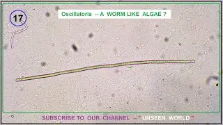 Pond water under Microscope - Oscillatoria Worm like Filament Algae